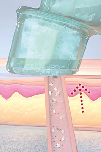 hydrafacial-schritt3-neu