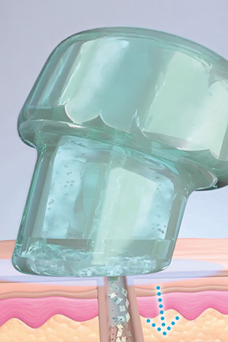 hydrafacial-schritt2-neu