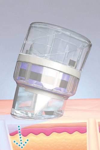 hydrafacial-schritt4-neu