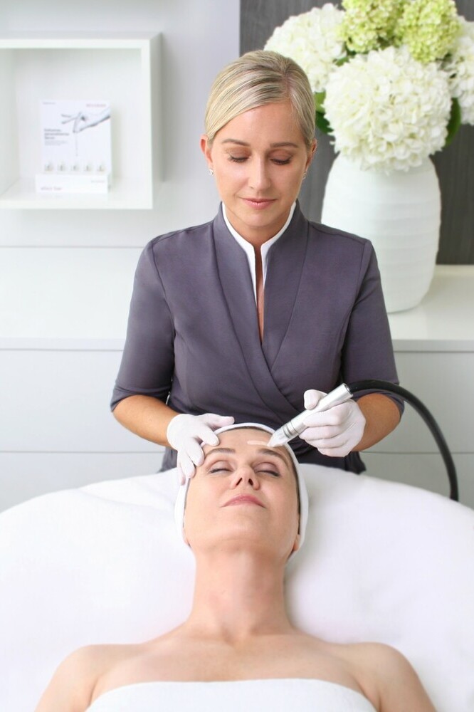 MDA-Mikrodermabrasion-Reviderm